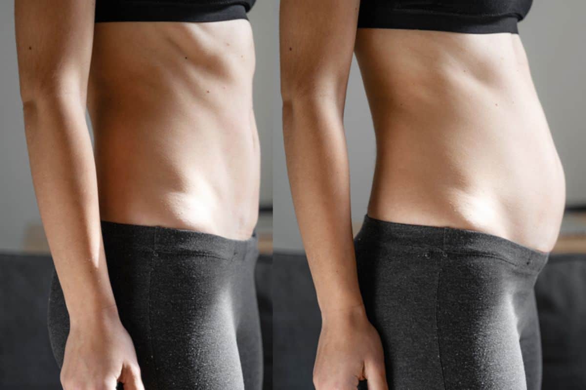 How long does diastasis recti take to improve Leicester?