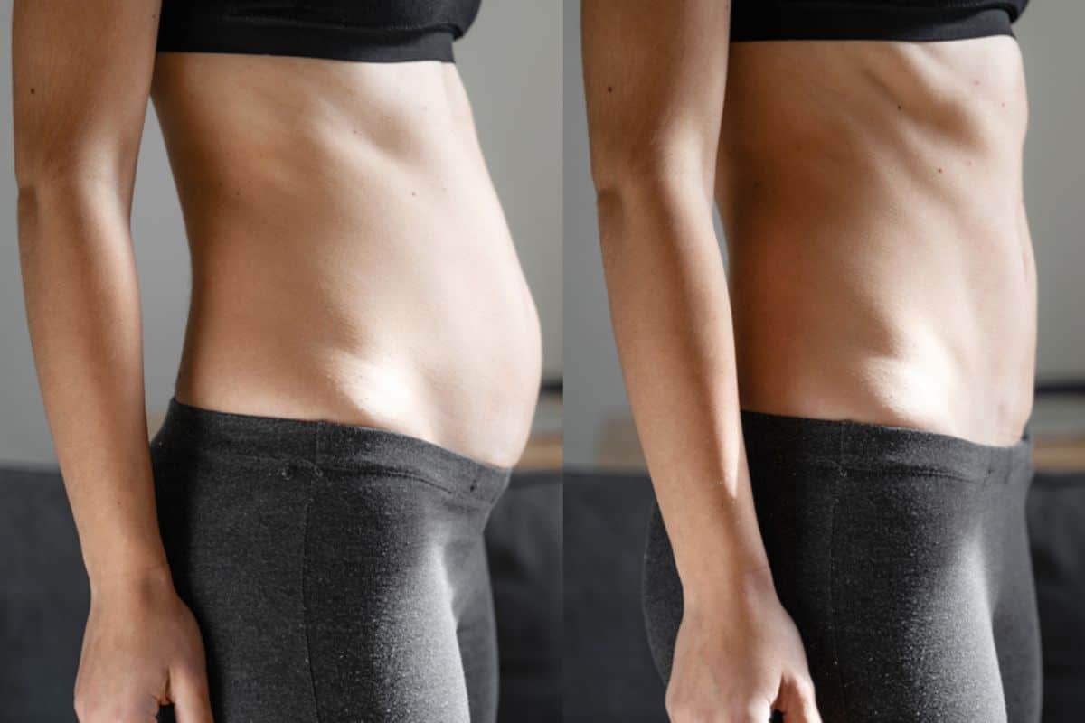 Post-Pregnancy: What Happens to Your Abdominal Muscles After Birth Leicester