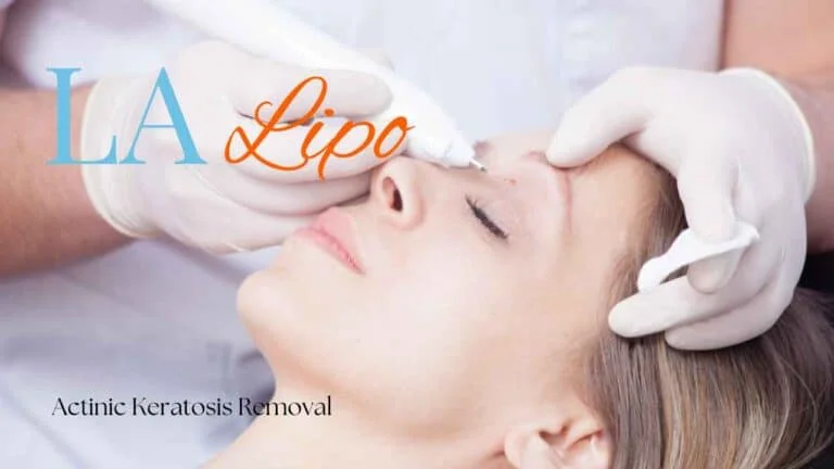 Woman receiving Actinic Keratosis Removal Treatment Leicester
