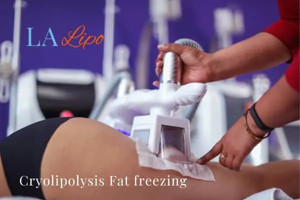 women getting fat freezing Leicester