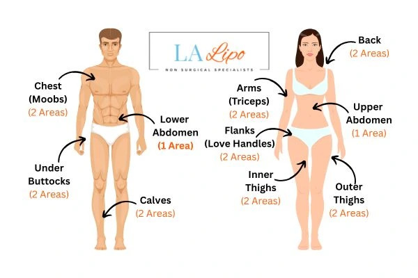 LA LIPO Cryolipolysis Areas Leicester