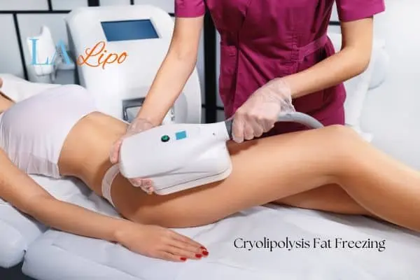 Woman receiving coolsculpting Leicester treatment on her thighs