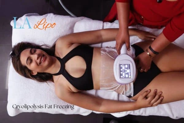 woman getting cryolipolysis Leicester