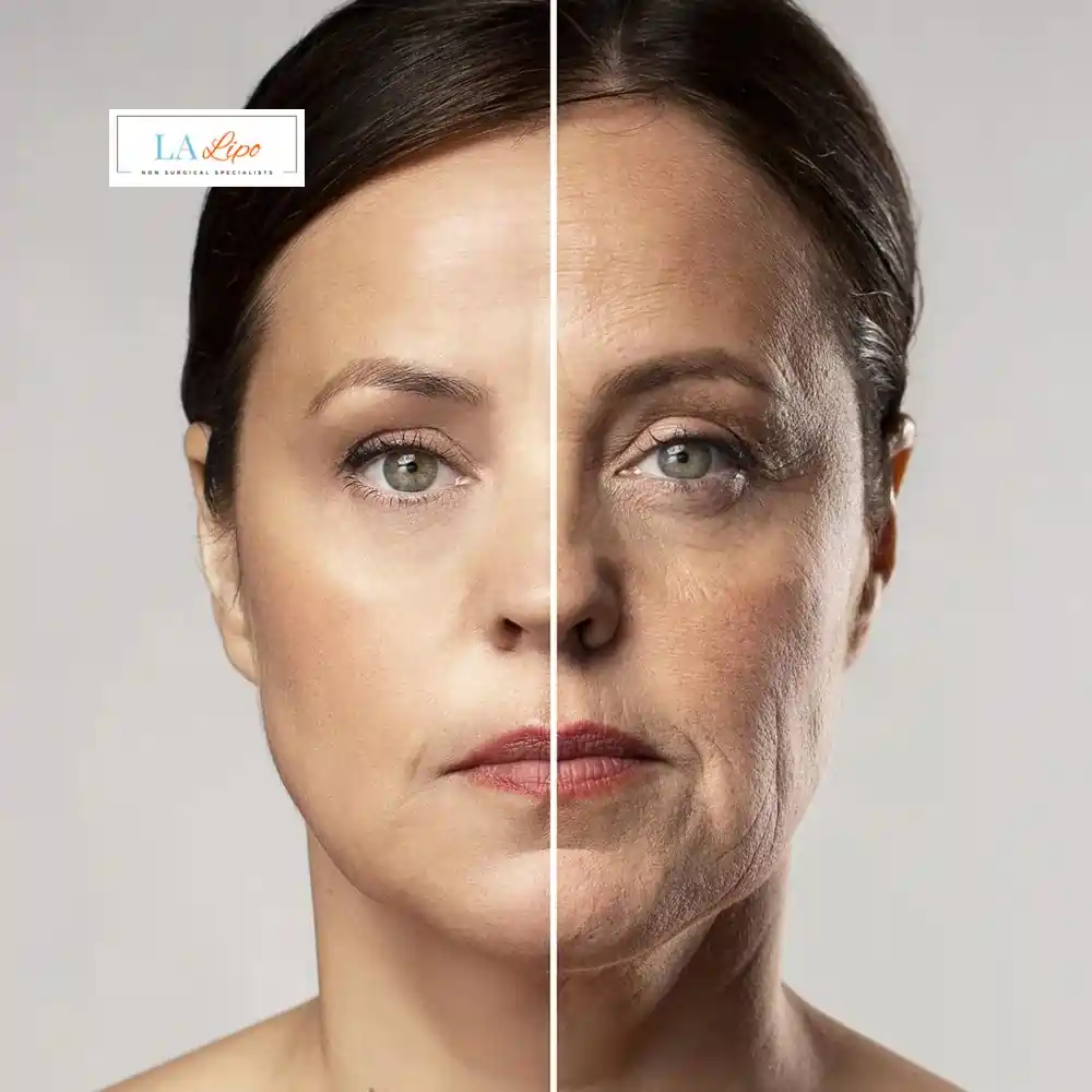 How Can You Tell If Non-Surgical Skin Tightening Is Right for You Leicester?