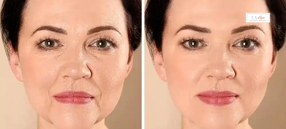 How Long Does It Take to See Results and How Long Do They Last Leicester?
