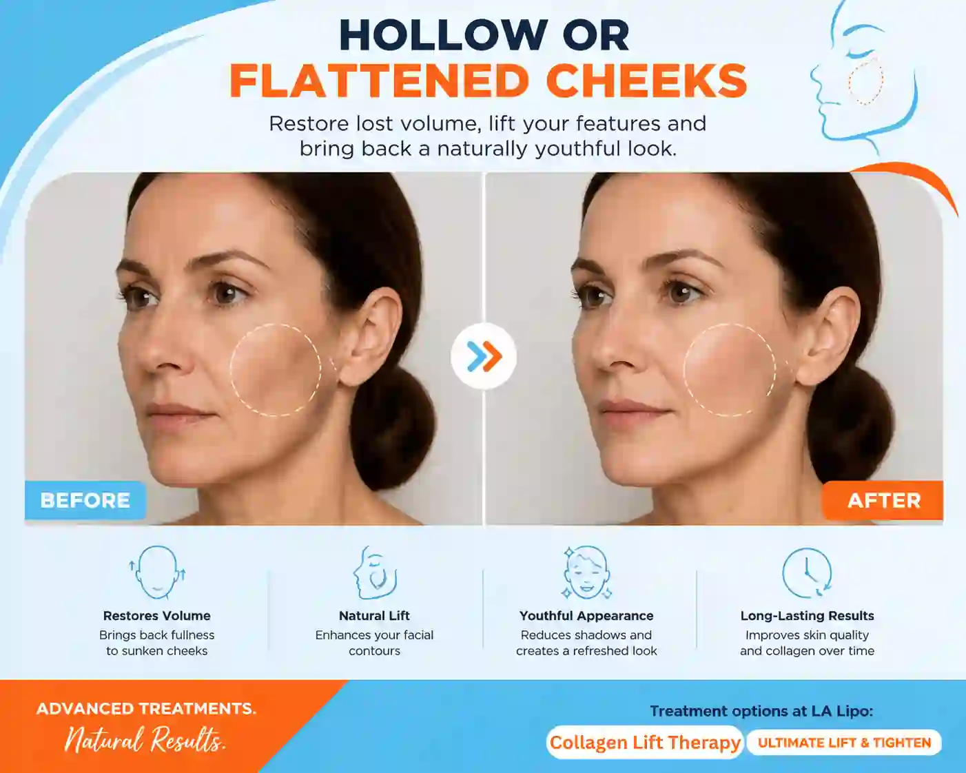 Sign #4: Hollow or Flattened Cheeks Leicester