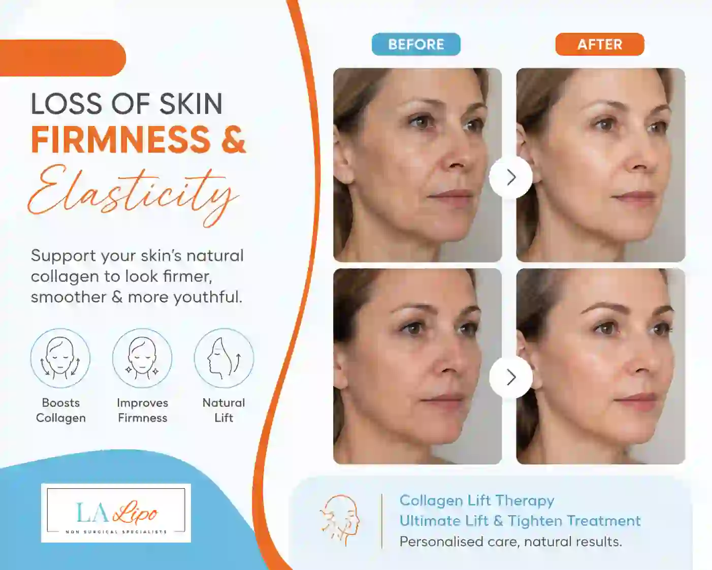 Sign #7: Loss of Skin Firmness and Elasticity Leicester
